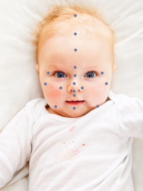 Acupuncture bébé annecy
